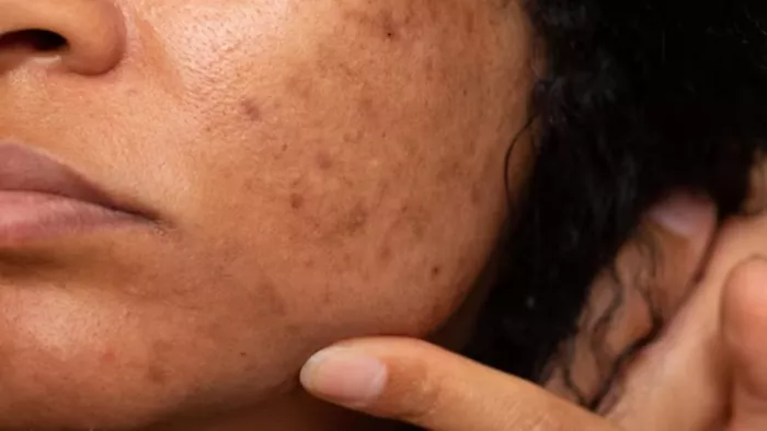 चेहरे के दाग-धब्बे मिनटों में दूर कर देंगे ये घरेलू फेस स्क्रब्ज