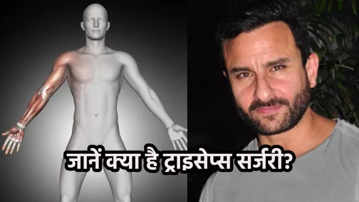 Saif Ali Khan Tricep Surgery: सैफ अली खान की हुई ट्राइसेप सर्जरी