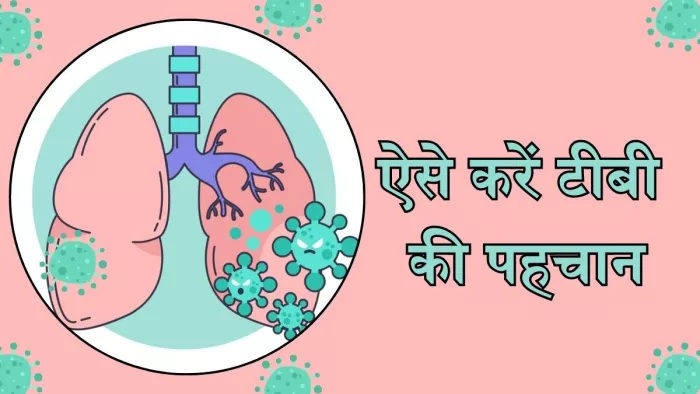 इन लक्षणों से करें टीबी की पहचान