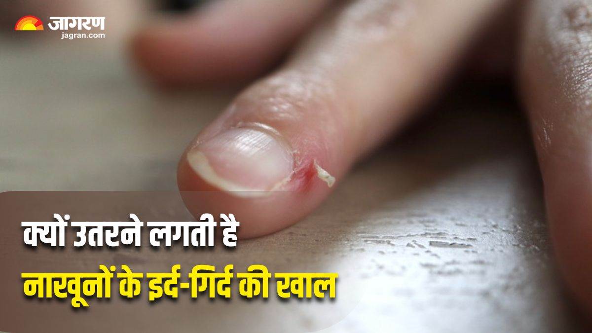 https://www.jagranimages.com/images/newimg/23032025/23_03_2025-peeling_skin_around_the_nails_23904640.jpg