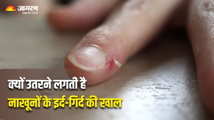 कभी सोचा है, क्यों उतरने लगती है उंगलियों के किनारों की खाल? (Image Source: Freepik)