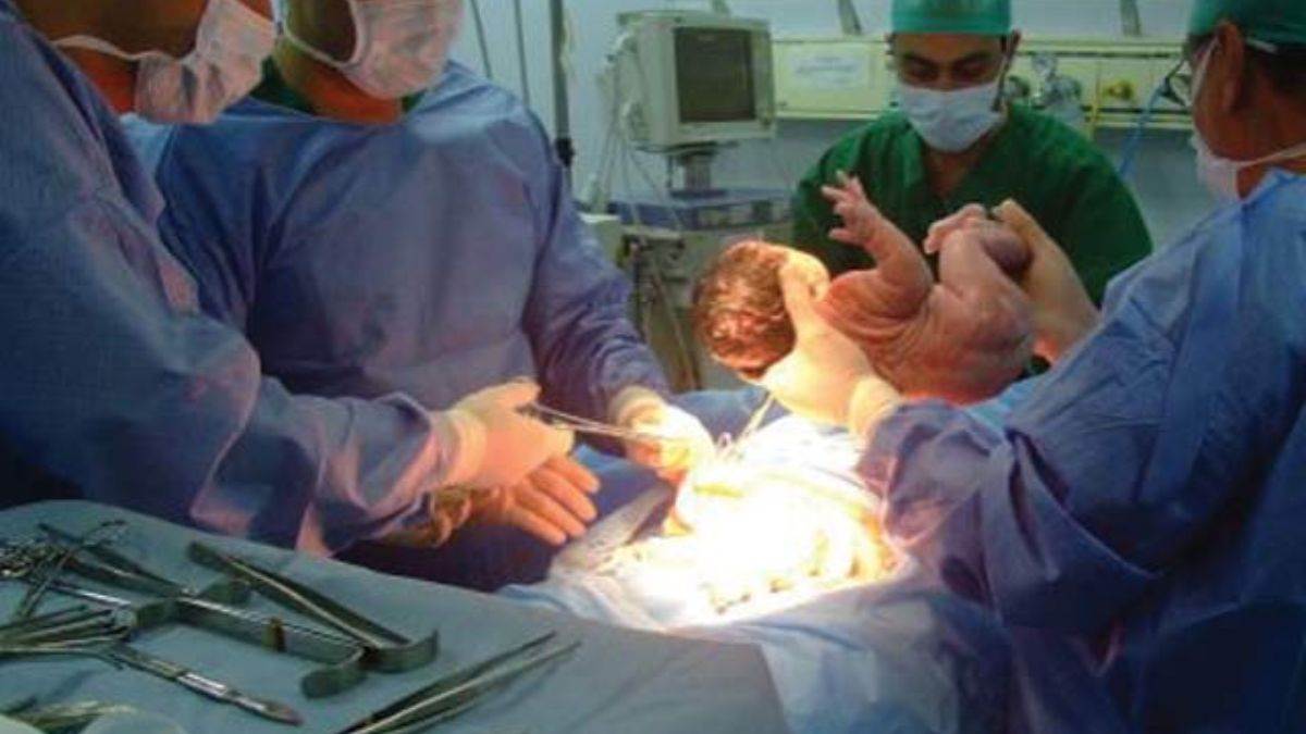 https://www.jagranimages.com/images/newimg/23062024/23_06_2024-cesarean_delivery_in_patna_23744550_14299284.jpg