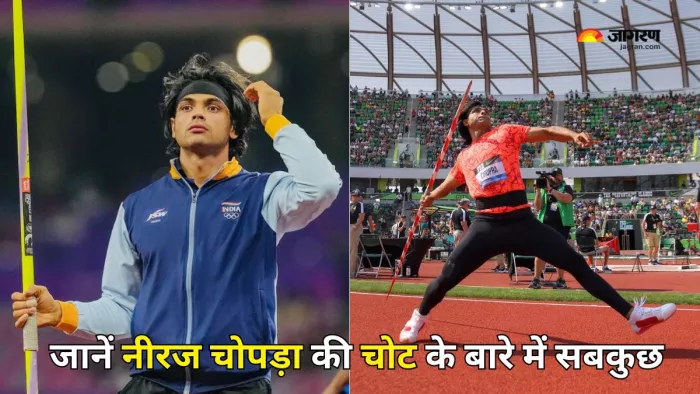 क्या है एडक्टर मसल स्ट्रेन? (Picture Courtesy: Instagram)
