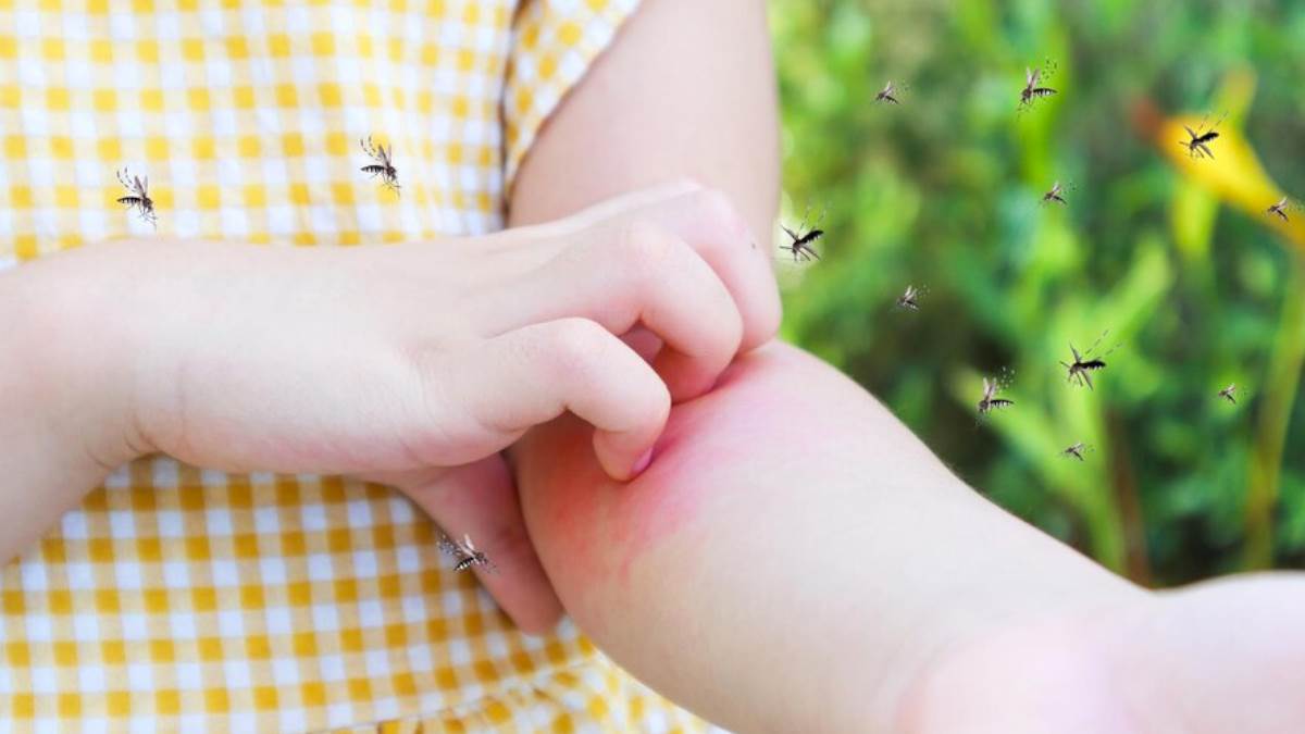 home remedies for mosquito and insects bites to stop itching