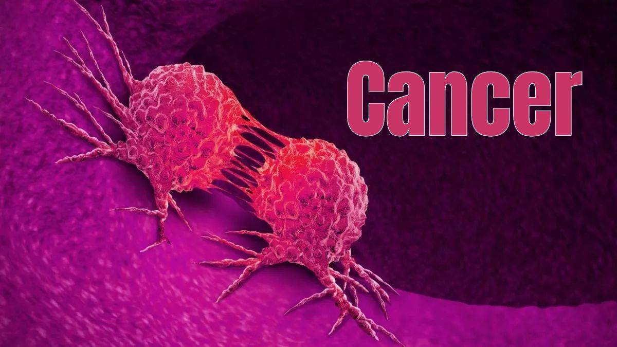 https://www.jagranimages.com/images/newimg/23072025/23_07_2025-delhi_cancer_23992595.jpg