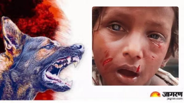 आंगनबाड़ी से पढ़ाई कर घर लौट रहे चार वर्षीय बच्चे पर कुत्तोें के झुंड ने किया हमला।