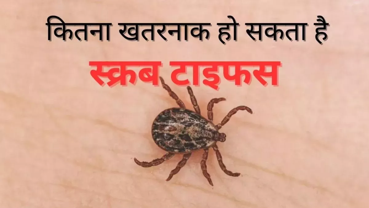 सावधान! हिमाचल में स्क्रब टायफस का पहला मामला, बरसात में जानलेवा बन जाता है एक कीट, जान लीजिए बचाव के उपाय