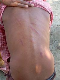 assistant teacher beat up the child mercilessly and threatened on protest in bareilly