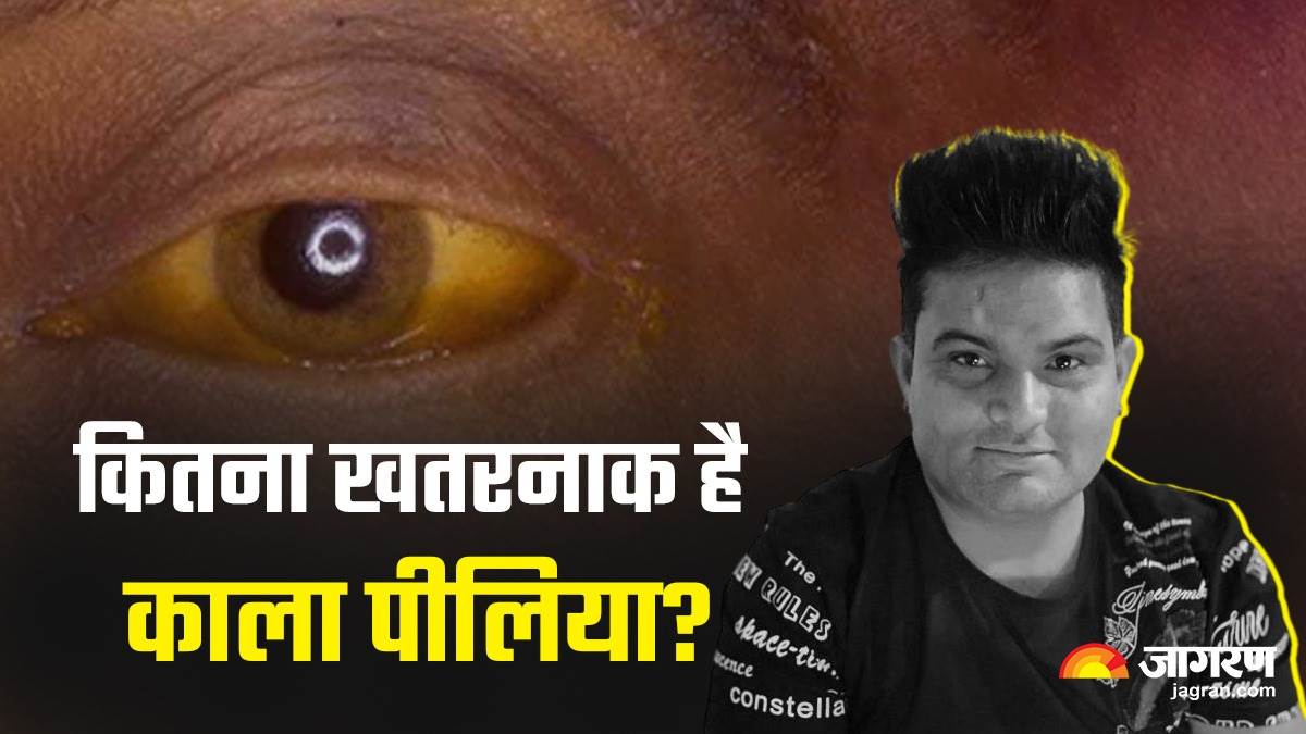 https://www.jagranimages.com/images/newimg/23082023/23_08_2023-kala_pilia_raju_punjabi_23509970.jpg