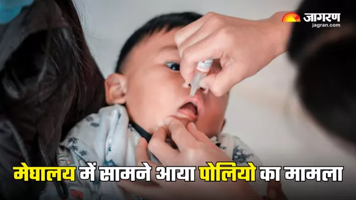 मेघायल में दो साल के बच्चे को हुआ Vaccine-Derived Polio (Picture Courtesy: Freepik)