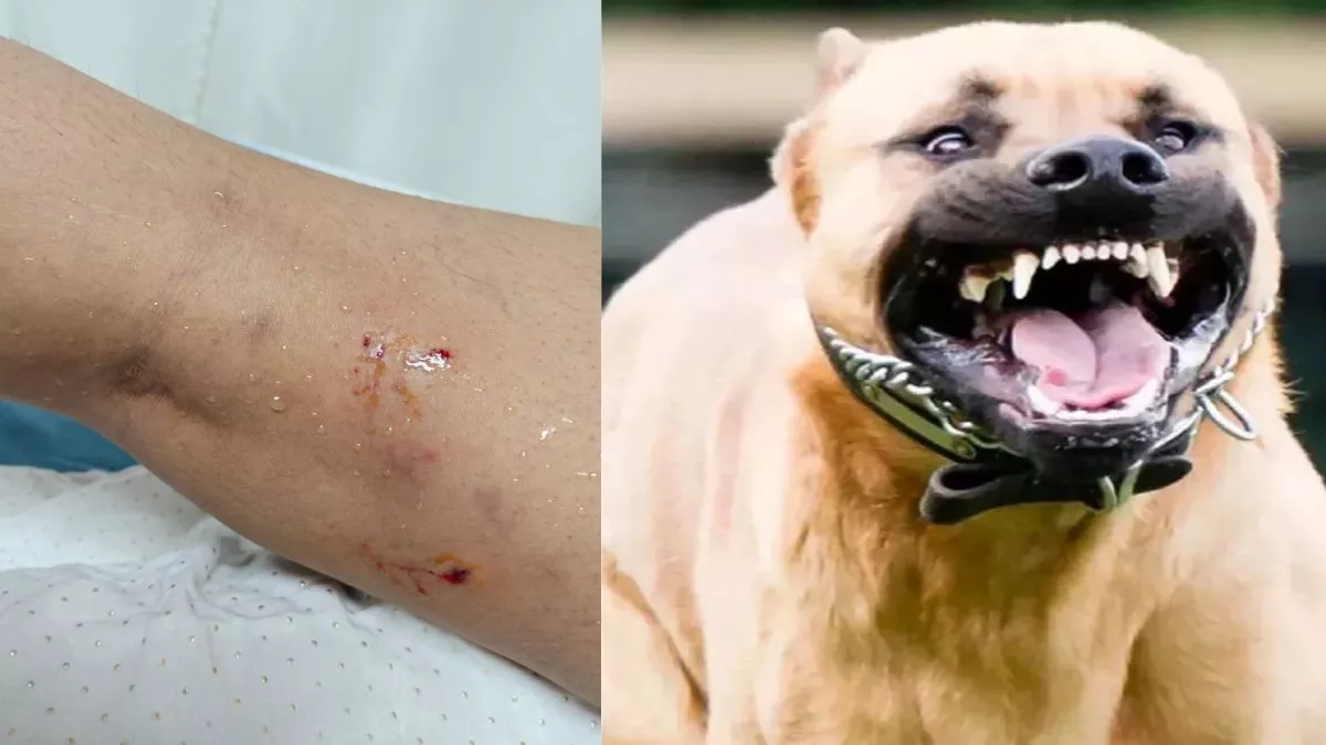 Dog Bite: गाजियाबाद में दूध लेने गई युवती को कुत्ते ने काटा, थाने में दर्ज कराई शिकायत