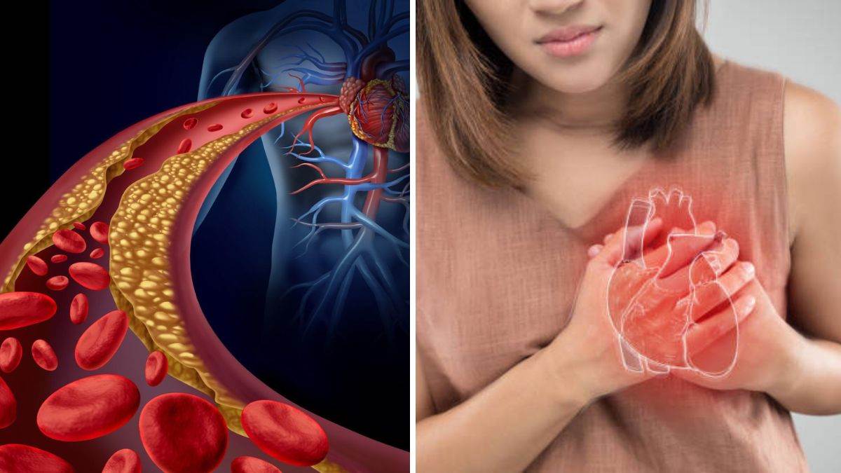https://www.jagranimages.com/images/newimg/23082025/23_08_2025-heart_attack_and_high_cholesterol_24022291.jpg