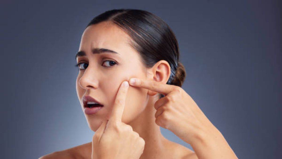 https://www.jagranimages.com/images/newimg/23082025/23_08_2025-pimples_popping_24022475.jpg