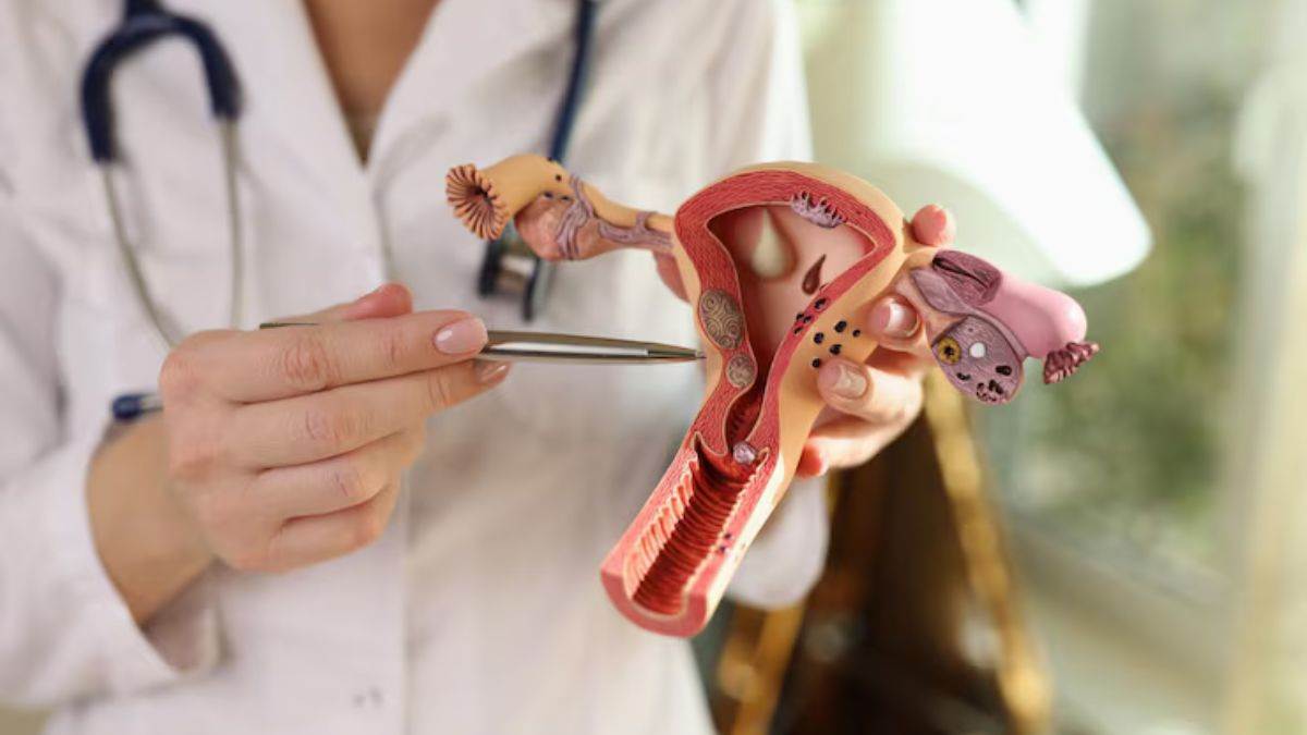 https://www.jagranimages.com/images/newimg/23082025/23_08_2025-uterine_cancer_dna_risk_factors_24022107.jpg