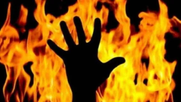 बेटी की शादी के उधार लिए रुपये नहीं लौटाने पर जिंदा जलाया, गंभीर हालत में भर्ती