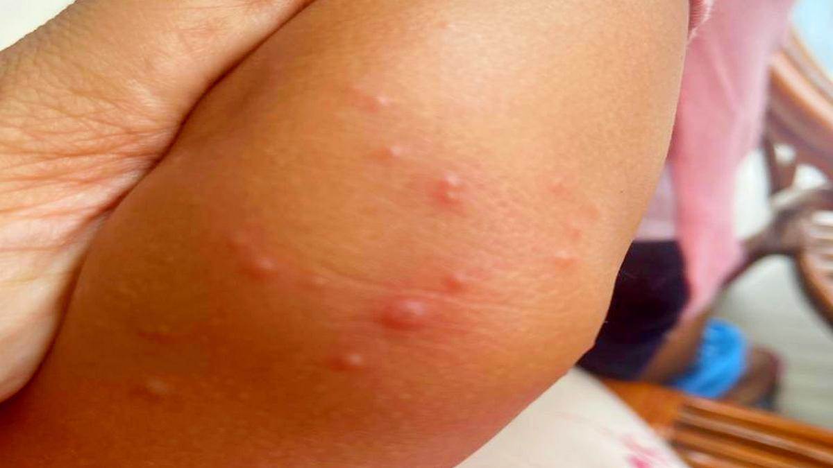 बीमारी में बच्चे को भूख नहीं लगती और बुखार रहता है। प्रतीकात्मक फोटो