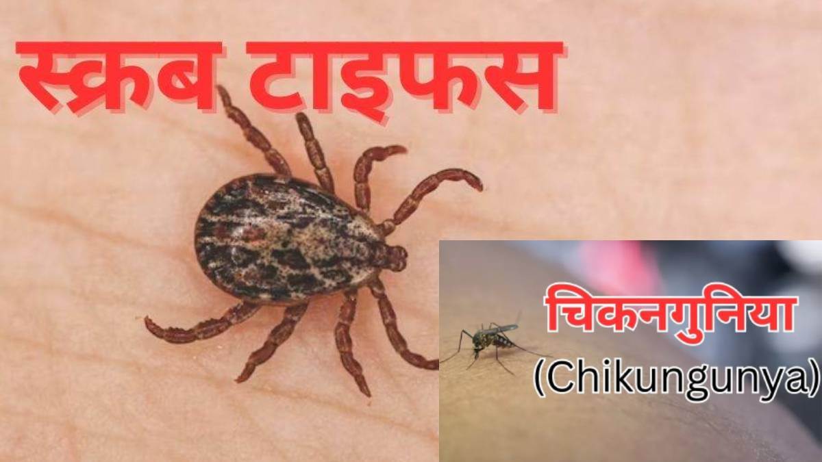 along with dengue now scrub typhus and chikungunya also attack in dehradun crowd of patients in doon hospital know the symptoms