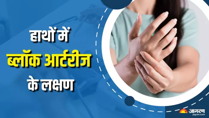 कैसे लगाएं ब्लॉक आर्टरीज का पता? (Picture Courtesy: Freepik)