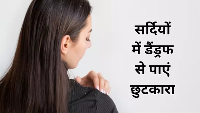 इन घरेलू नुस्खों से पाएं डैंड्रफ से छुटकारा