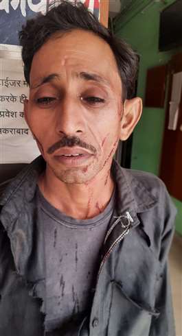 वैक्‍सीन लगवाने की पूछने पर राशन बांट रहे कर्मचारियों के साथ मारपीट की गई।