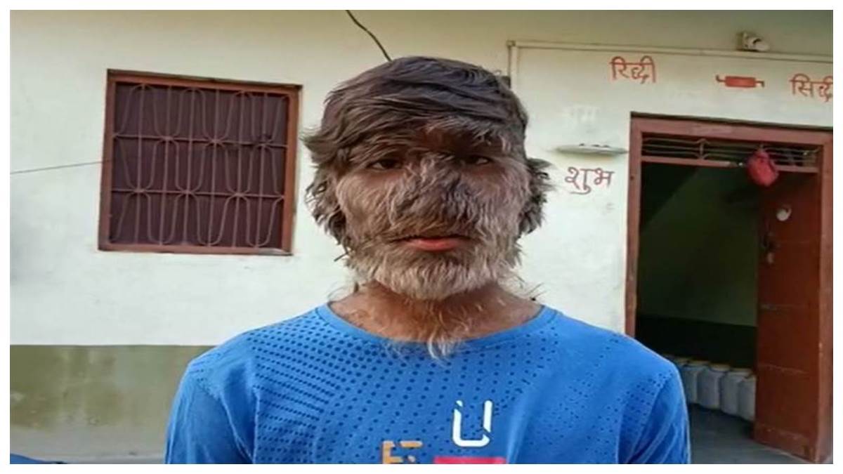 https://www.jagranimages.com/images/newimg/23112022/23_11_2022-ratlamlalit_23222765_142854772.jpg