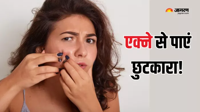 Acne ठीक करने के लिए नेचुरल जड़ी-बूटियां हैं सेफ ऑप्शन (Picture Courtesy: Freepik)