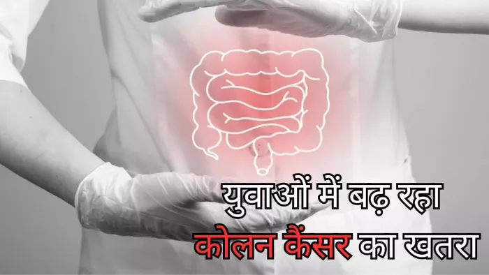 ये आदतें बढ़ाती हैं कोलन कैंसर का खतरा