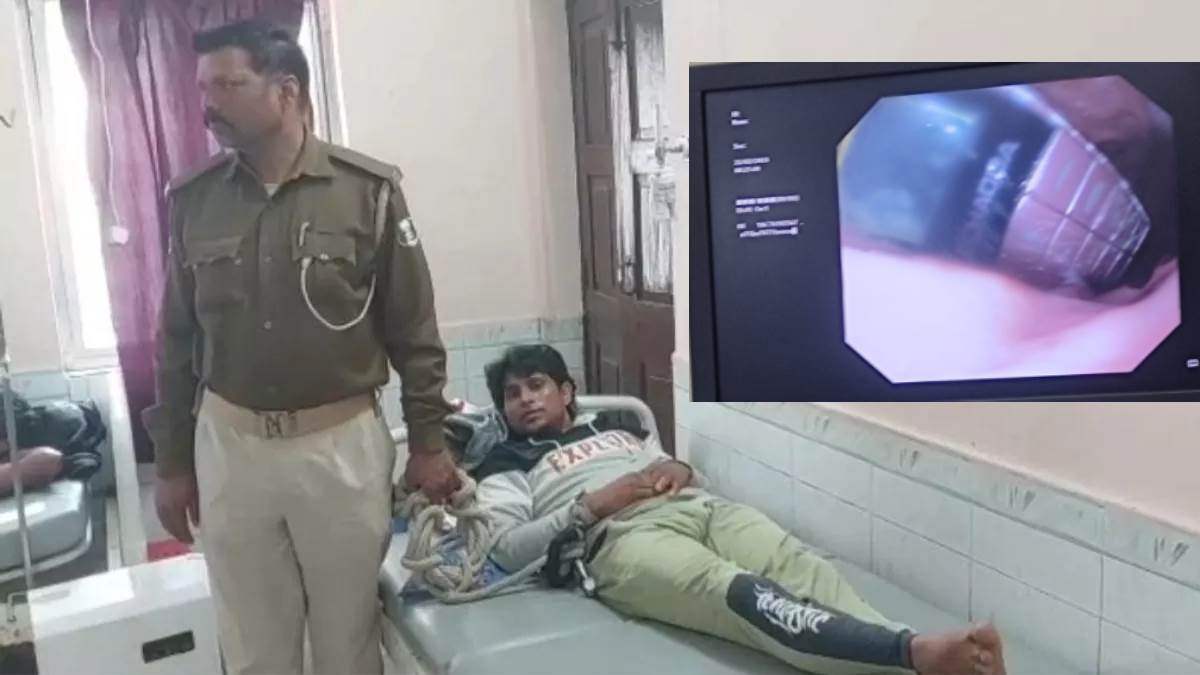 bihar doctors removed mobile from prisoners stomach without operation