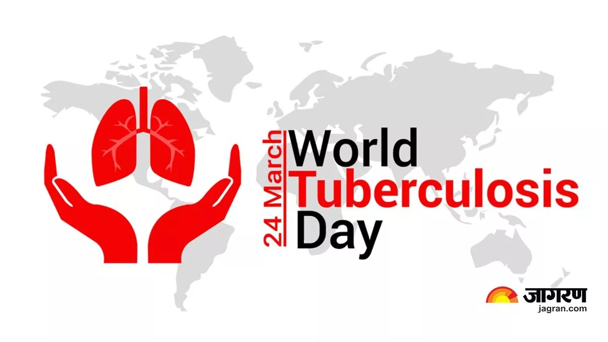 World TB Day 2023: गोरखपुर में पांव पसार रही टीबी, शहर में गांवों से दोगुणा मिल रहे रोगी, ये है बड़ी वजह
