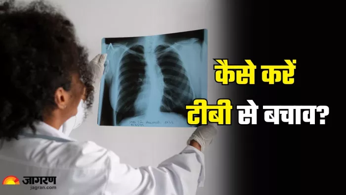 डॉक्टर ने बताए टीबी के बचने के उपाय (Picture Credit- Freepik)