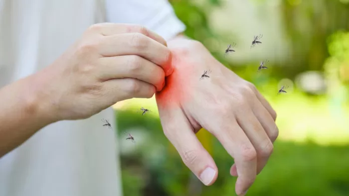 Mosquito Bites Home Remedies: मच्छर काटने के बाद करें ये इलाज