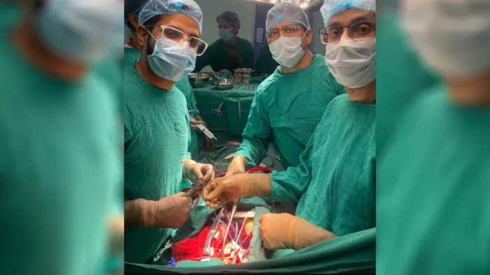 चंबा के सिहुंता की महिला की ट्रिपल वाल्व हार्ट सर्जरी के दौरान टांडा मेडिकल कॉलेज के सीटीवीएस विभाग के विशेषज्ञ।