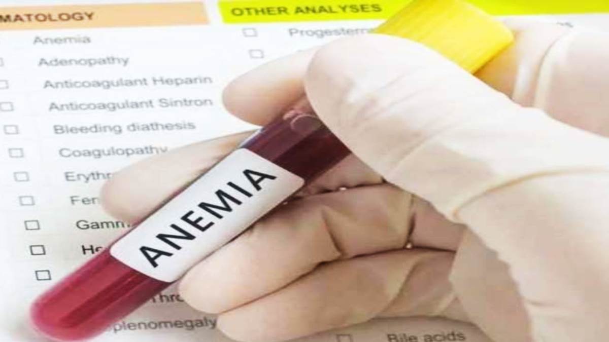 https://www.jagranimages.com/images/newimg/24052025/24_05_2025-anemia_latest_news_23945680.jpg