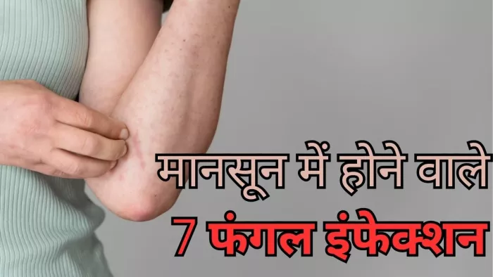 बरसात के मौसम बढ़ जाता है इन संक्रमणों का खतरा