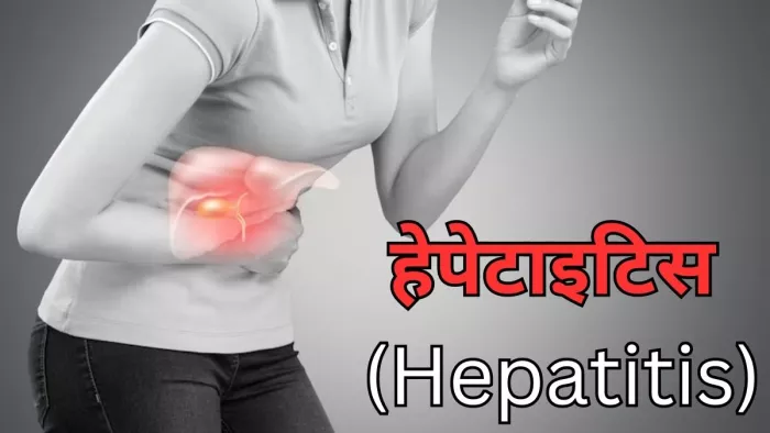 क्या है हेपेटाइसिस, जानें इसके लक्षण,कारण और बचाव