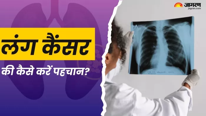 लंग कैंसर के इन लक्षणों से रहें सावधान! (Picture Courtesy: Freepik)