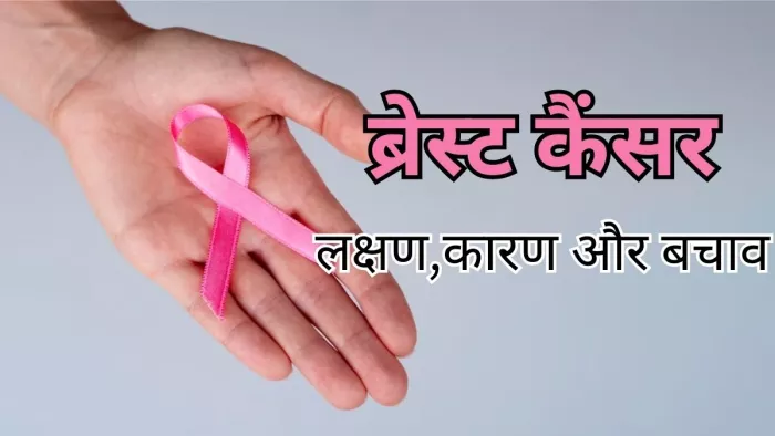 एक्सपर्ट से जानें ब्रेस्ट कैंसर से जुड़ी सभी बातें