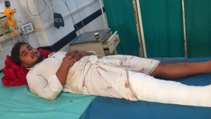 नूंह हिंसा का आरोपी ओसामा एनकाउंटर में घायल