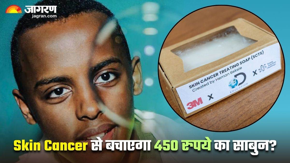 https://www.jagranimages.com/images/newimg/24082024/24_08_2024-heman_bekele_skin_cancer_soap_23783886.jpg