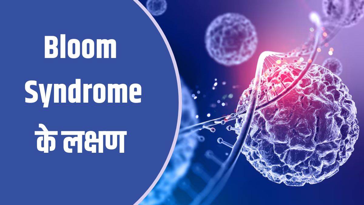 https://www.jagranimages.com/images/newimg/24082025/24_08_2025-bloom_syndrome_24023204.jpg