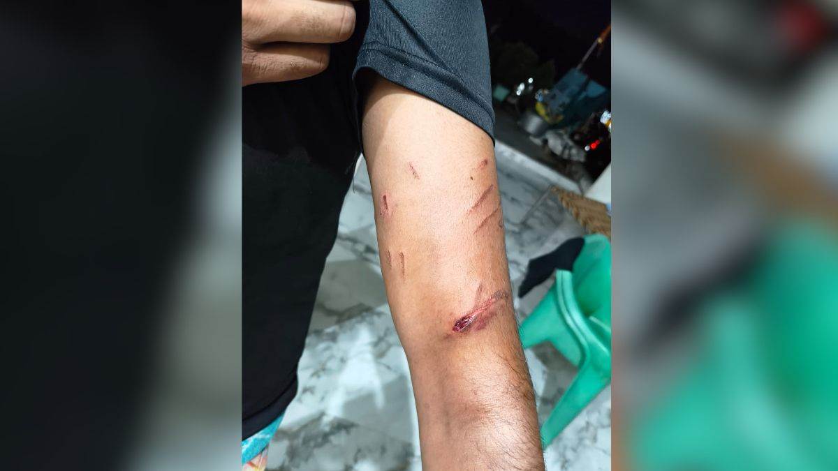 https://www.jagranimages.com/images/newimg/24082025/24_08_2025-dog_bite_kasganj_24023892.jpg