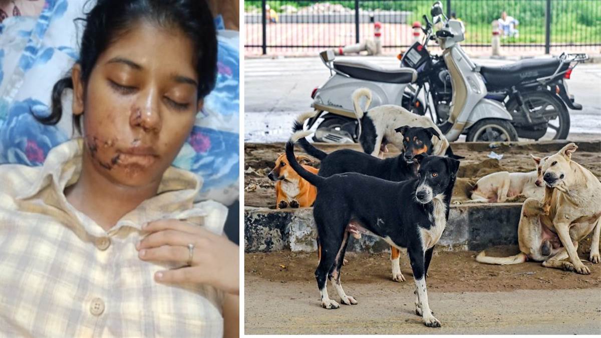 https://www.jagranimages.com/images/newimg/24082025/24_08_2025-kanpur_stray_dog_attack_24023925.jpg