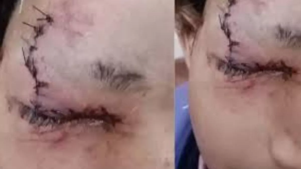 Himachal News: स्कूल से घर आते 8 साल के बच्चे की आंख में घुसी पेंसिल, दादा की शिकायत पर दर्ज हुआ केस