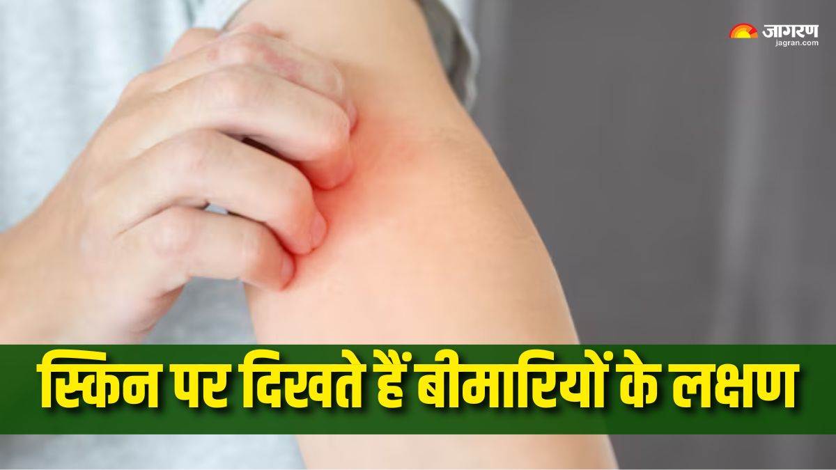 https://www.jagranimages.com/images/newimg/24082025/24_08_2025-skin_changes_health_issues_24023470.jpg