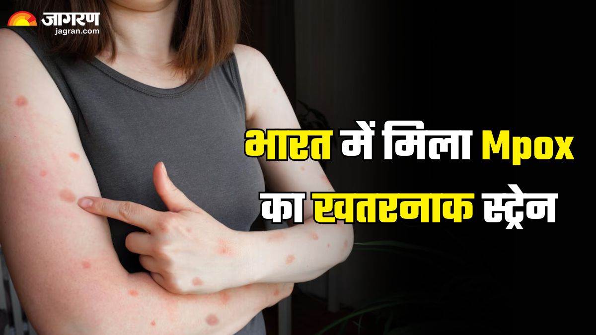 https://www.jagranimages.com/images/newimg/24092024/24_09_2024-mpox_in_india_1_23803511.jpg