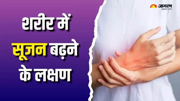 कहीं शरीर में बढ़ तो नहीं रही है सूजन? (Picture Courtesy: Freepik)