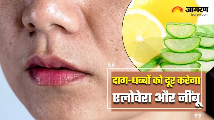 कील-मुंहासों के बाद चेहरे पर छूट गए हैं दाग-धब्बे? एलोवेरा और नींबू का ऐसे करें इस्तेमाल (Image Source: Freepik)
