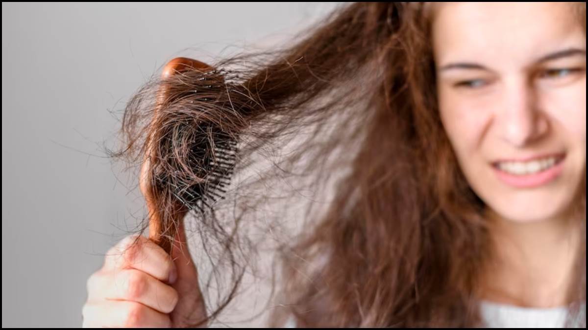 https://www.jagranimages.com/images/newimg/25042023/25_04_2023-hairfall_1_23395134.jpg