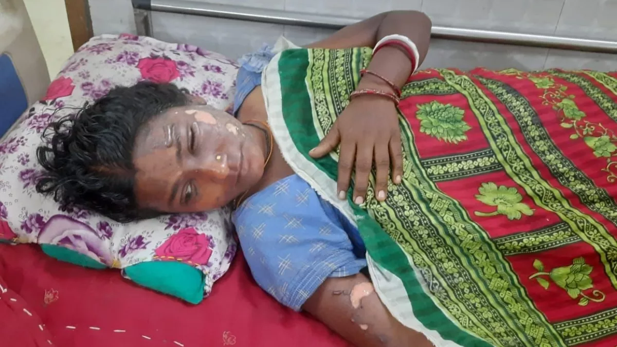 Bihar: ननद की एंट्री लेते ही खतरनाक हुआ सास-बहू का झगड़ा, मां-बेटी ने मिलकर उड़ेला चेहरे पर चावल का खौलता पानी