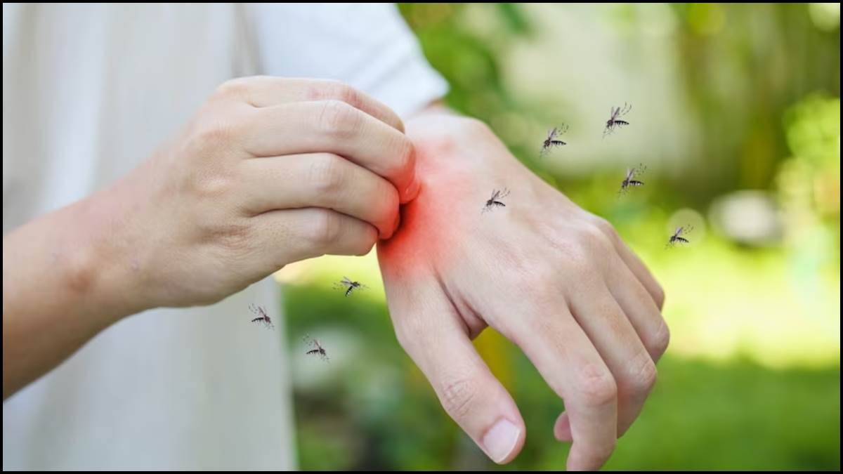 try these home remedies to get instant relief from mosquito bite